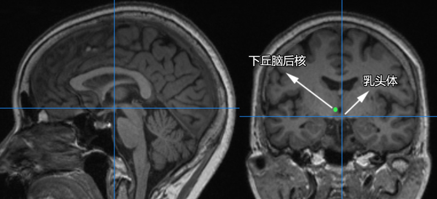 六步十图认识下丘脑361度无死角