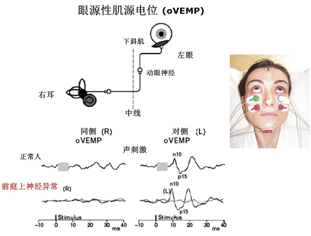 吴子明前庭功能检查