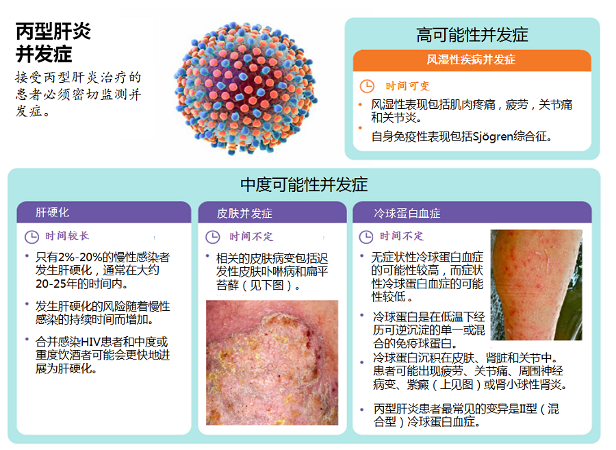 一图掌握 | 丙型肝炎的并发症  hcv感染患者往往合并多种hcv肝外表现