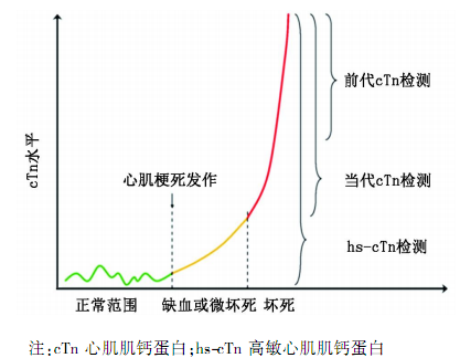 q&a:高敏肌钙蛋白临床应用问答