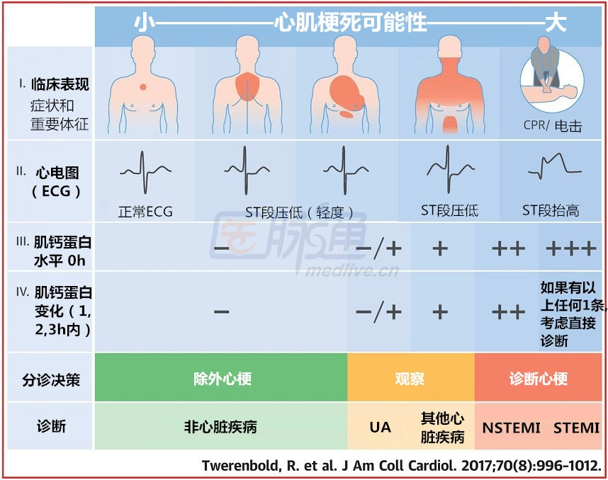 肌钙蛋白 肌钙蛋白升高提示心肌损伤.