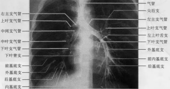 掌握胸片阅读基本功,晋级影像高手!
