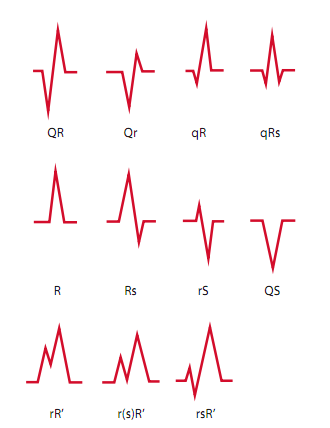 10分钟掌握标准心电图的基础知识  qrs复合波的波形方向或偏移决定了