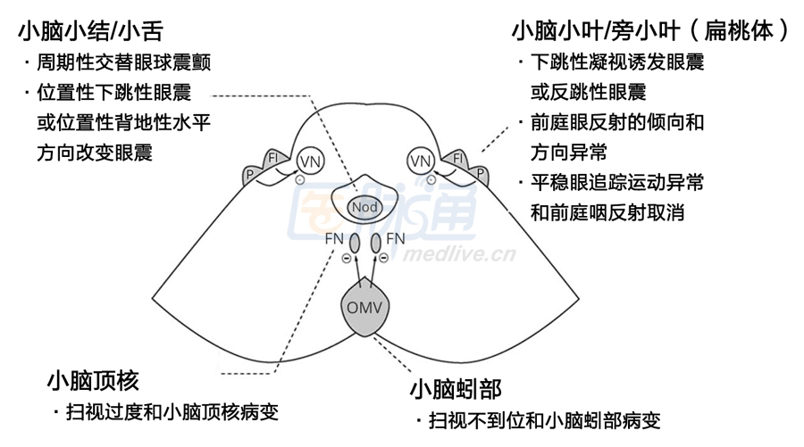 掌握这些眼震知识点,眩晕诊断定位不再难