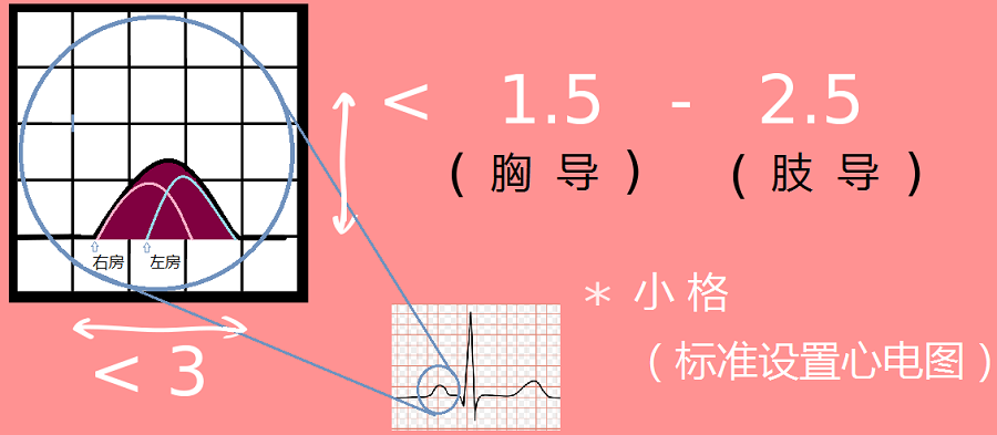 心电图正常p波示意图