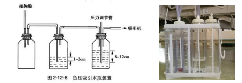 胸腔闭式引流,这四点你未必懂