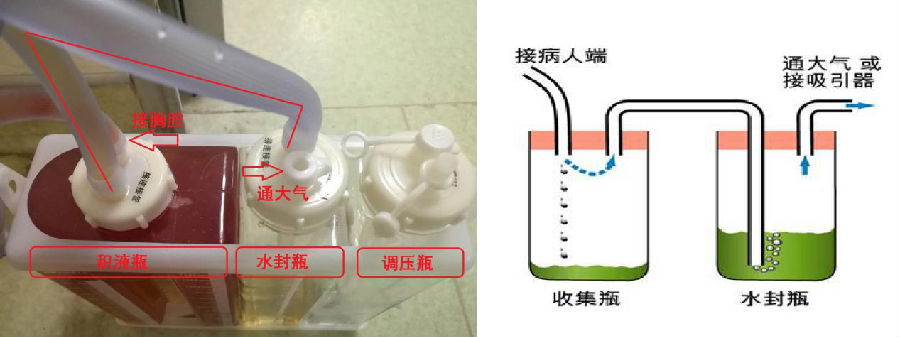 临床上我们用的三腔水封