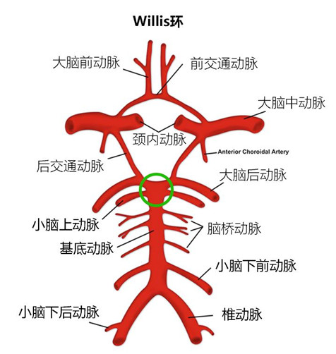 willis环与基底动脉尖位置