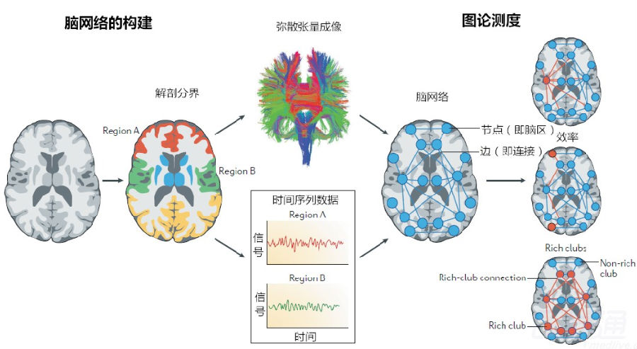 脑网络图论理解脑小血管病变的新途径